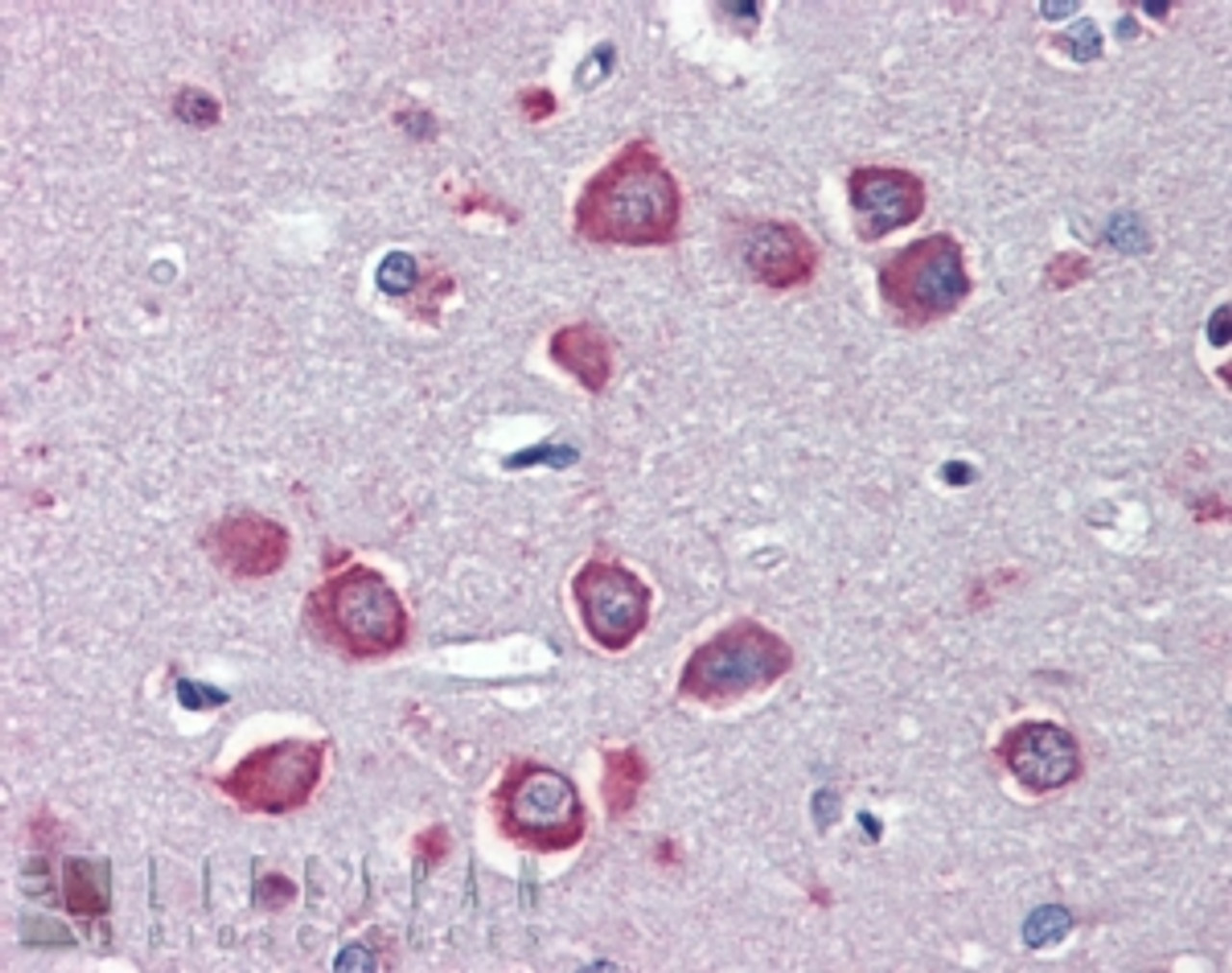 42-258 (2ug/ml) staining of HEK293 lysate (35ug protein in RIPA buffer) . Primary incubation was 1 hour. Detected by chemiluminescence.