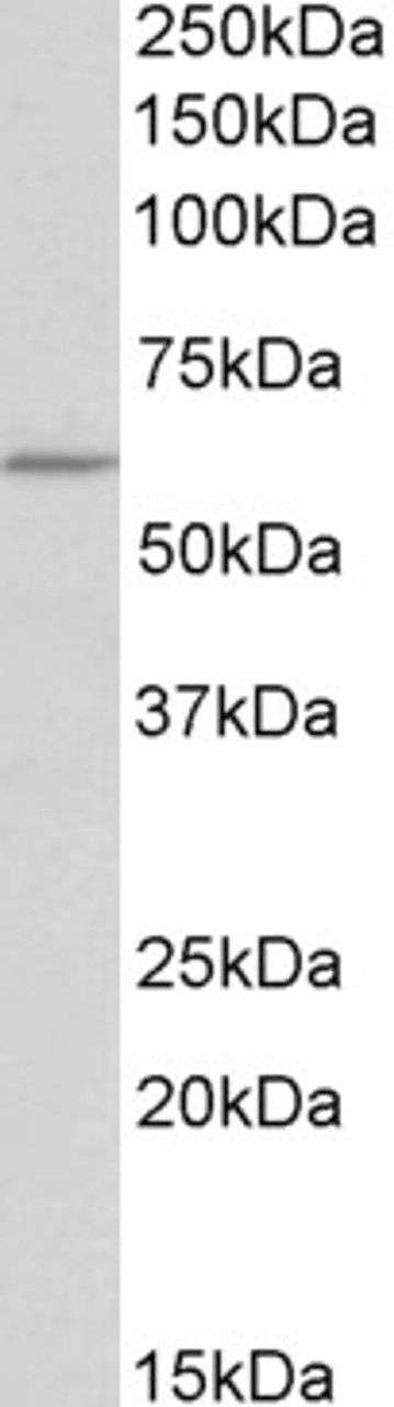 42-336 (0.5ug/ml) staining of Mouse Heart lysate (35ug protein in RIPA buffer) . Primary incubation was 1 hour. Detected by chemiluminescence.