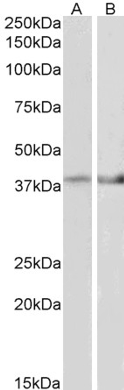 42-376 (2ug/ml) staining of Mouse Kidney lysate (35ug protein in RIPA buffer) . Primary incubation was 1 hour. Detected by chemiluminescence.