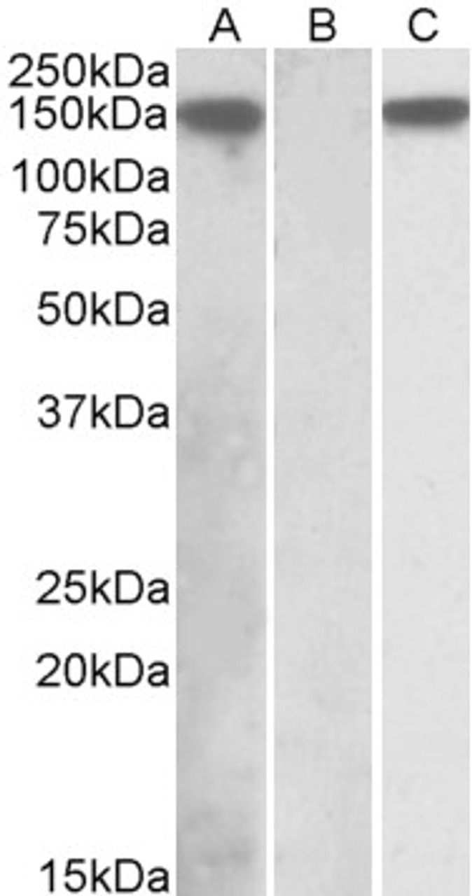 42-381 (0.1ug/ml) staining of Human Lymph Nodes lysate (35ug protein in RIPA buffer) . Detected by chemiluminescence.