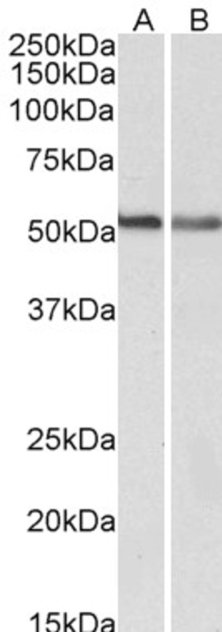 42-383 (5ug/ml) staining of paraffin embedded Human Kidney. Steamed antigen retrieval with citrate buffer pH 6, AP-staining.