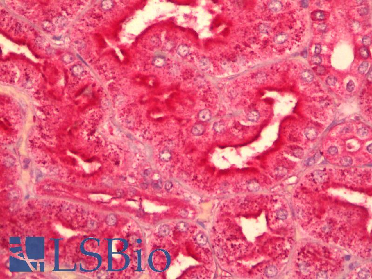 42-411 (1ug/ml) staining of Mouse Skin lysate (35ug protein in RIPA buffer) . Primary incubation was 1 hour. Detected by chemiluminescence.