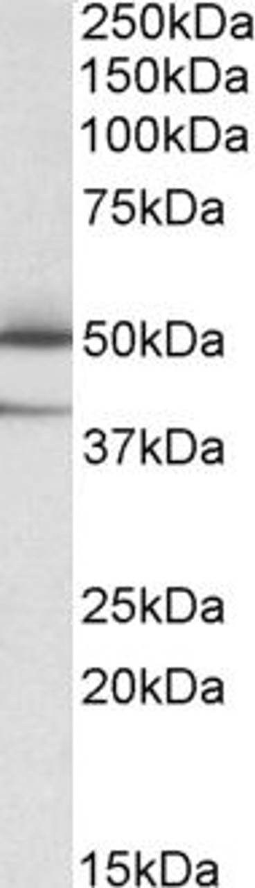 HEK293 lysate (10ug protein in RIPA buffer) overexpressing Human EPM2AI with DYKDDDDK tag probed with 42-433 (1ug/ml) in Lane A and probed with anti-DYKDDDDK Tag (1/1000) in lane C. Mock-transfected HEK293 probed with 42-433 (1mg/ml) in Lane B. Primar