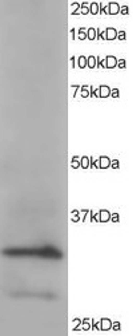 45-011 (3.8µg/ml) staining of paraffin embedded Human Spleen. Steamed antigen retrieval with citrate buffer pH 6, AP-staining.