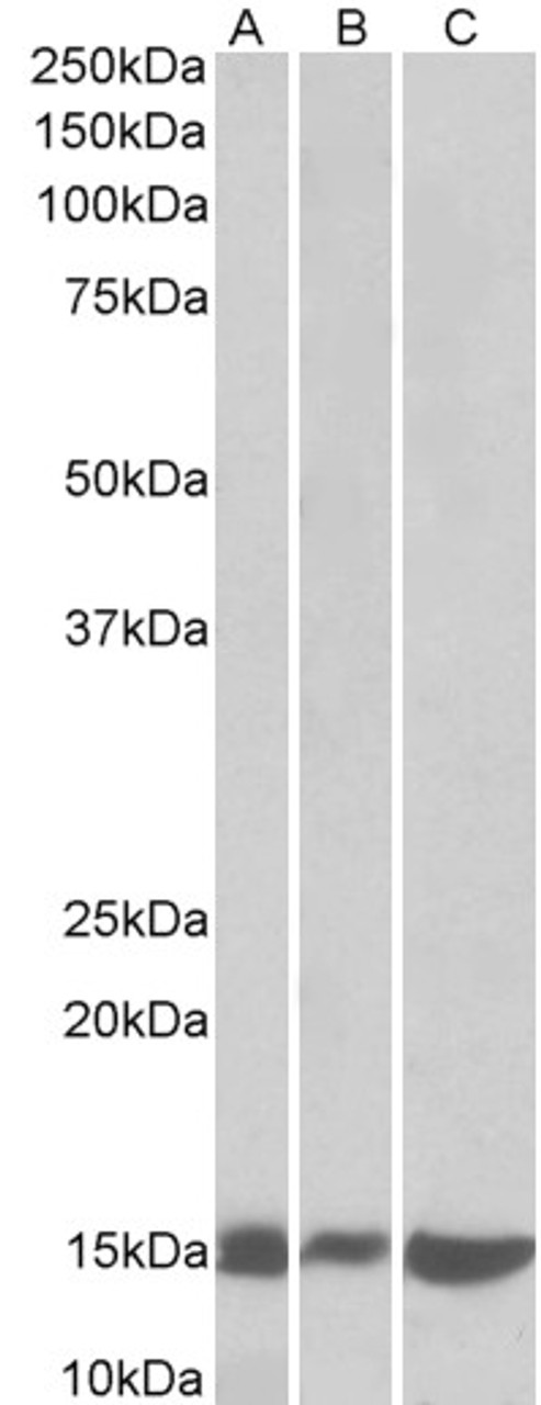 42-448 (0.3ug/ml) staining of Mouse Thymus lysate (35ug protein in RIPA buffer) . Primary incubation was 1 hour. Detected by chemiluminescence.