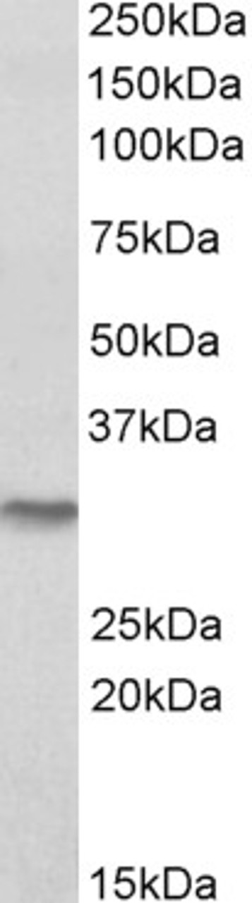 42-449 (0.3ug/ml) staining of Human Prostate lysate (35ug protein in RIPA buffer) . Primary incubation was 1 hour. Detected by chemiluminescence.