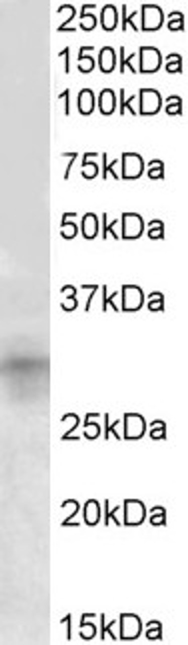 42-457 (0.3ug/ml) staining of Human Breast lysate (35ug protein in RIPA buffer) . Primary incubation was 1 hour. Detected by chemiluminescence.