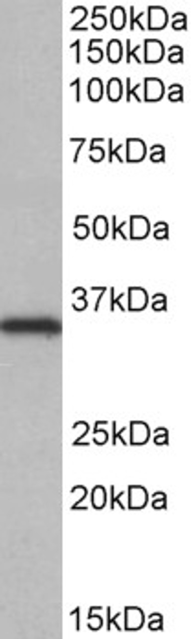 HEK293 lysate (10ug protein in RIPA buffer) overexpressing Human PCSK9 with C-terminal MYC tag probed with 42-463 (0.5ug/ml) in Lane A and probed with anti-MYC Tag (1/1000) in lane C. Mock-transfected HEK293 probed with 42-463 (1mg/ml) in Lane B. Primar
