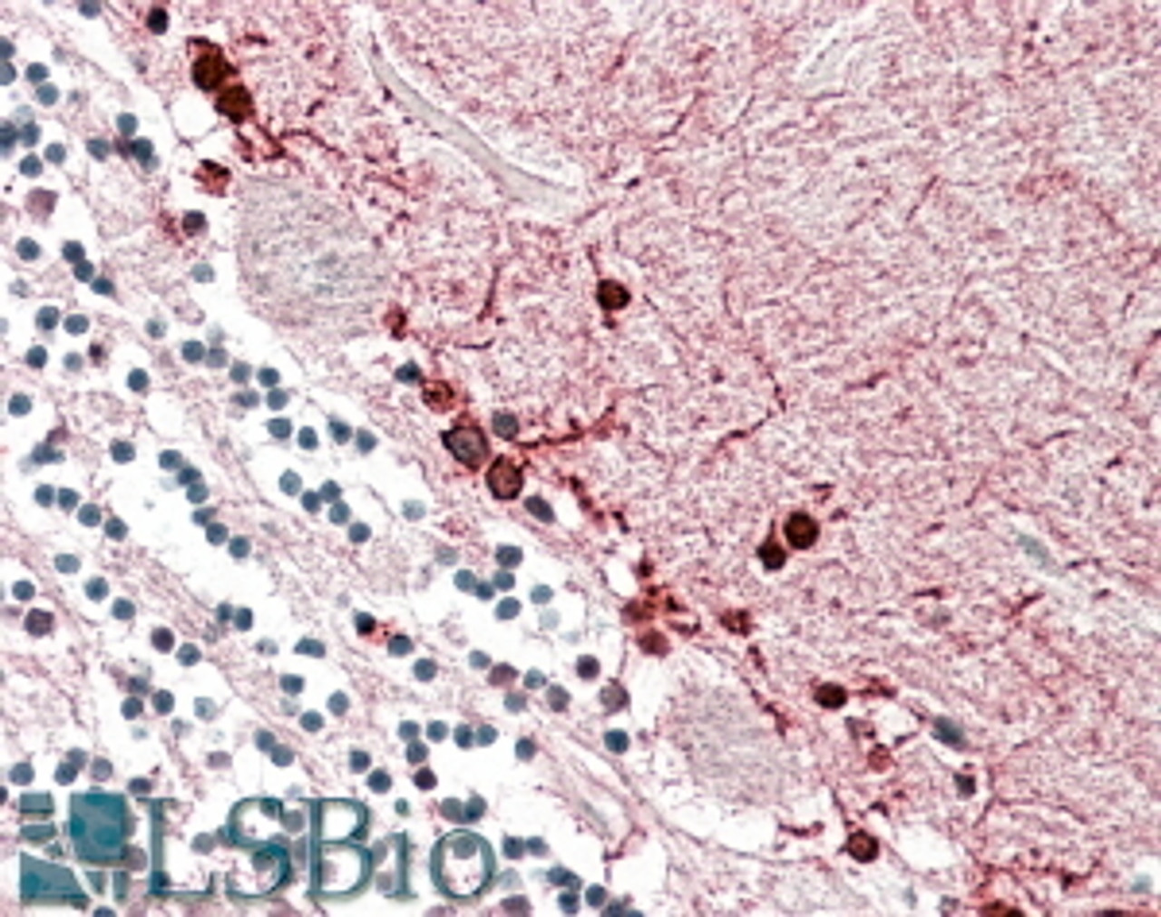 42-491 (0.1ug/ml) staining of Rat Retina lysate (35ug protein in RIPA buffer) . Primary incubation was 1 hour. Detected by chemiluminescence.