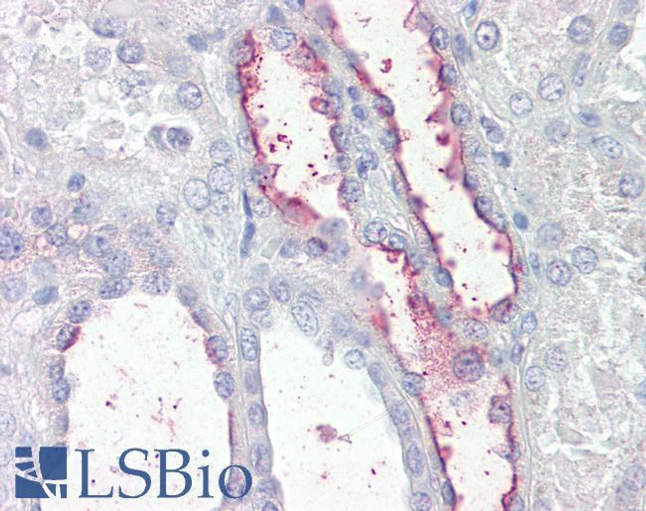 42-495 (2ug/ml) staining of Human Spleen lysate (35ug protein in RIPA buffer) .Detected by chemiluminescence.