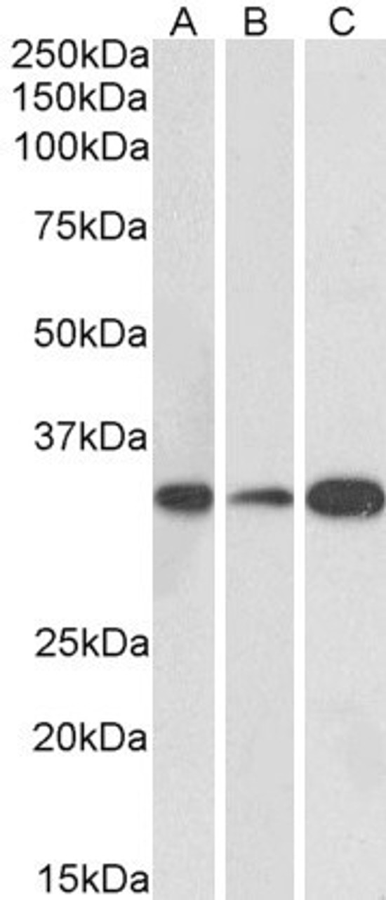 42-516 (1ug/ml) staining of Human Heart lysate (35ug protein in RIPA buffer) . Primary incubation was 1 hour. Detected by chemiluminescence.