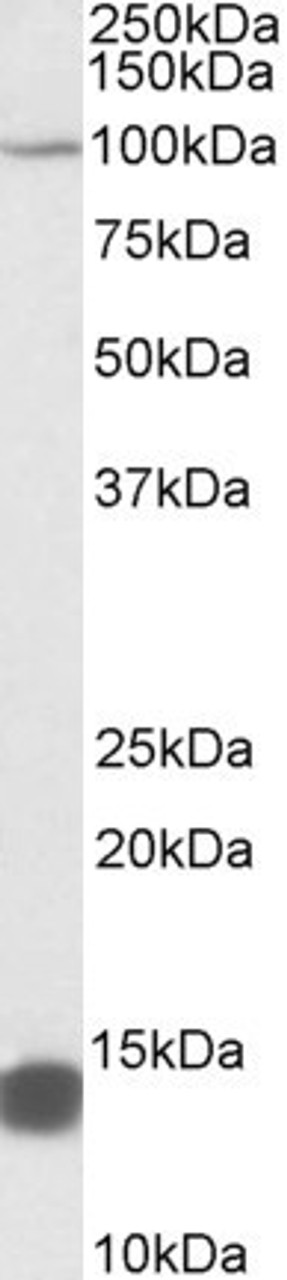 42-538 (0.3ug/ml) staining of K562 lysate (35ug protein in RIPA buffer) . Primary incubation was 1 hour. Detected by chemiluminescence.