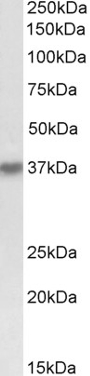 42-547 (0.5ug/ml) staining of HepG2 lysate (35ug protein in RIPA buffer) . Primary incubation was 1 hour. Detected by chemiluminescence.