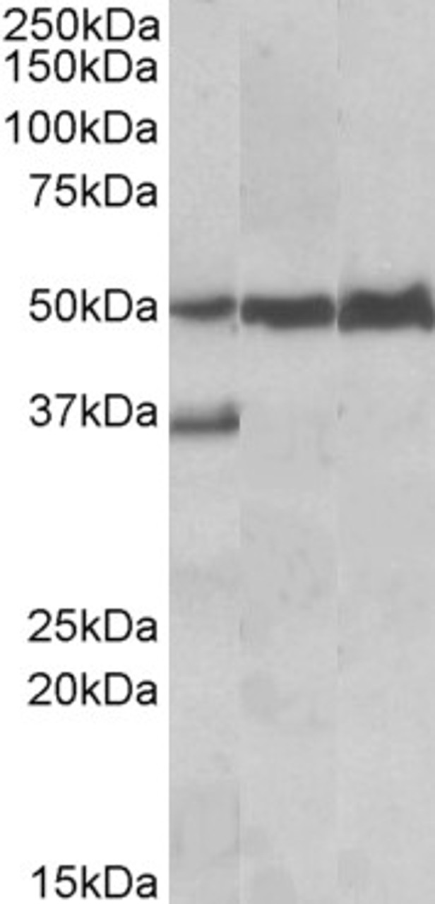 42-550 (2ug/ml) staining of K562 lysate (35ug protein in RIPA buffer) . Primary incubation was 1 hour. Detected by chemiluminescence.