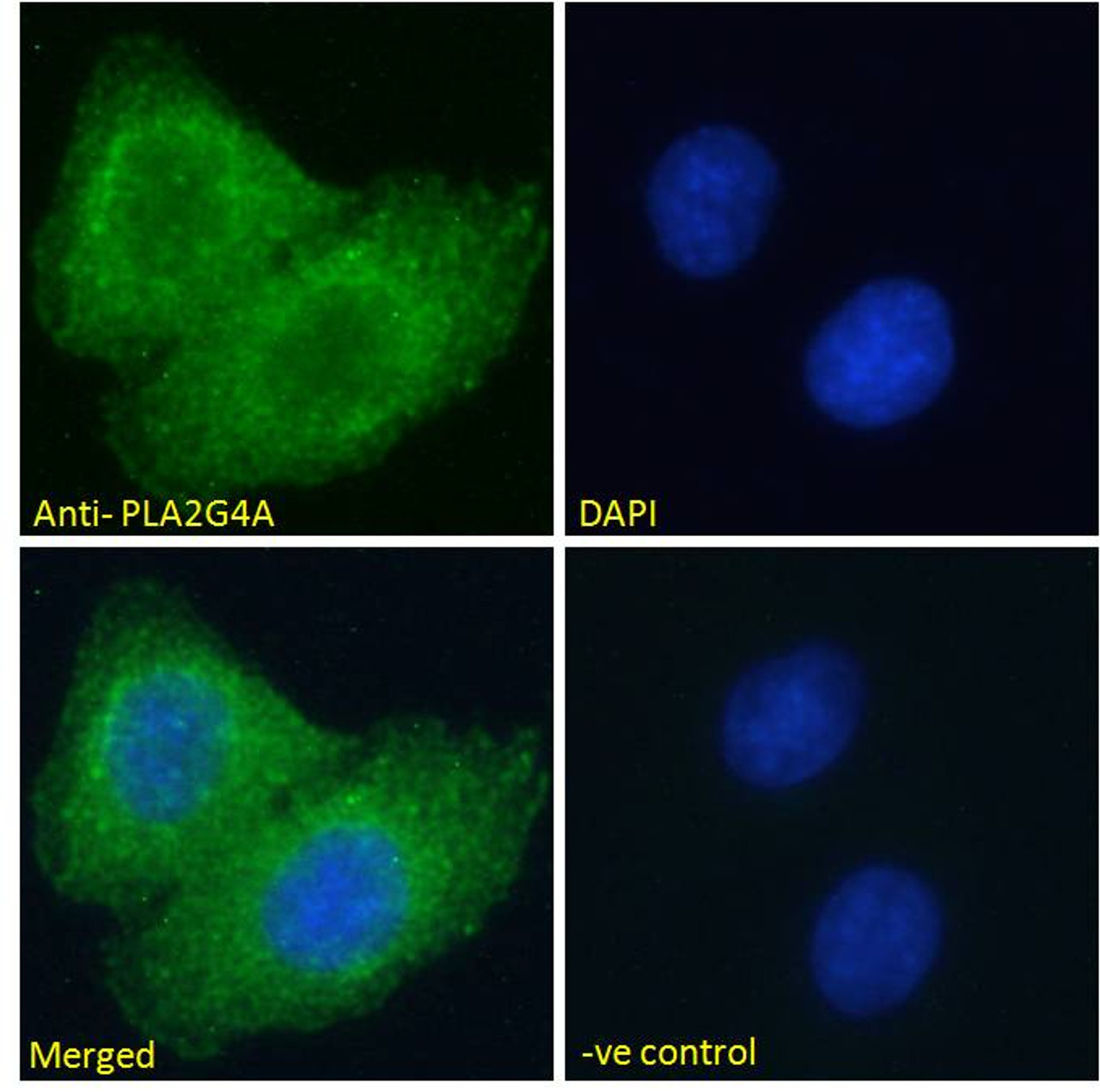 42-582 (0.3ug/ml) staining of Mouse Eye lysate (35ug protein in RIPA buffer) . Primary incubation was 1 hour. Detected by chemiluminescence.