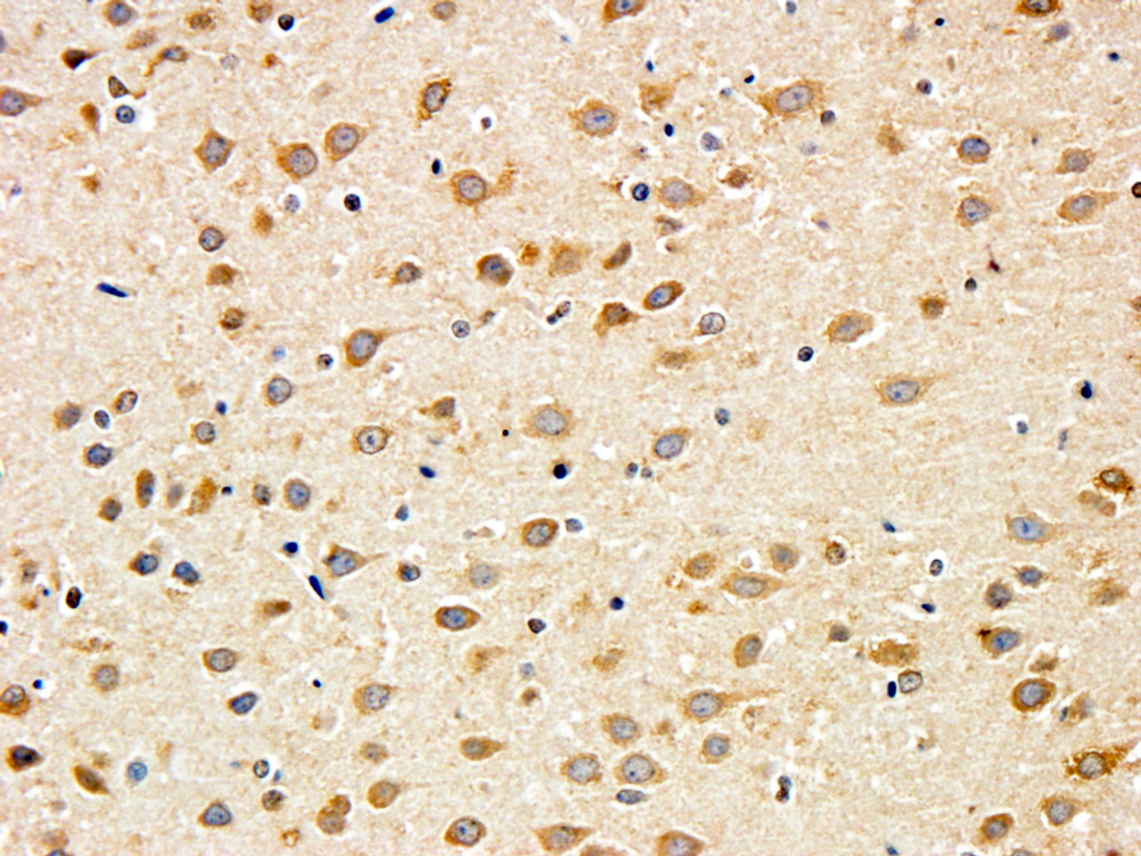 42-587 (0.5ug/ml) staining of Jurkat lysate (35ug protein in RIPA buffer) . Primary incubation was 1 hour. Detected by chemiluminescence.