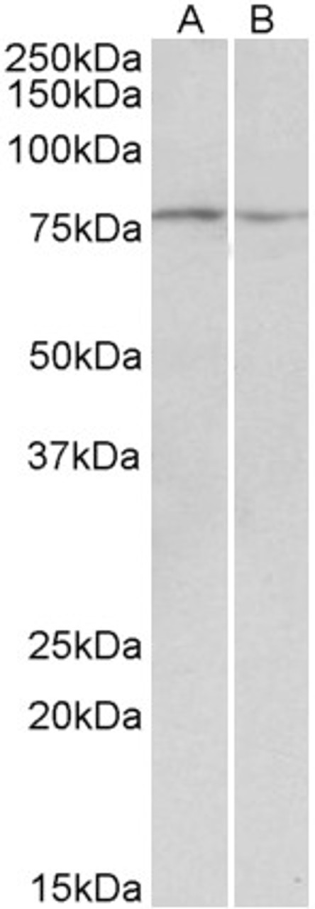 42-609 Immunofluorescence analysis of paraformaldehyde fixed A549 cells, permeabilized with 0.15% Triton. Primary incubation 1hr (10ug/ml) followed by Alexa Fluor 488 secondary antibody (2ug/ml) , showing cytoplasmic staining. The nuclear stain is DAPI (b