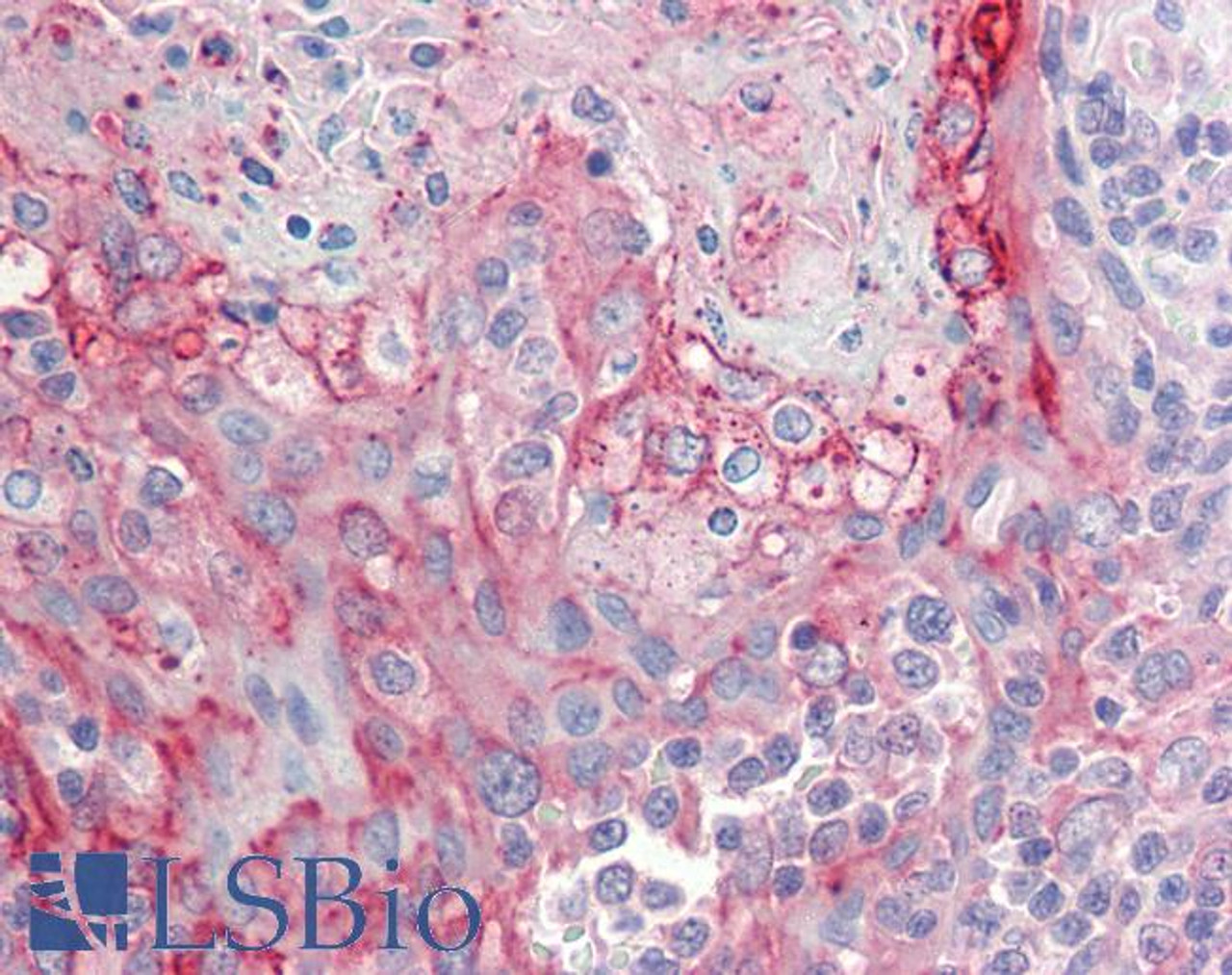 42-627 (3.8ug/ml) staining of paraffin embedded Human Cerebral Cortex. Steamed antigen retrieval with citrate buffer pH 6, AP-staining.