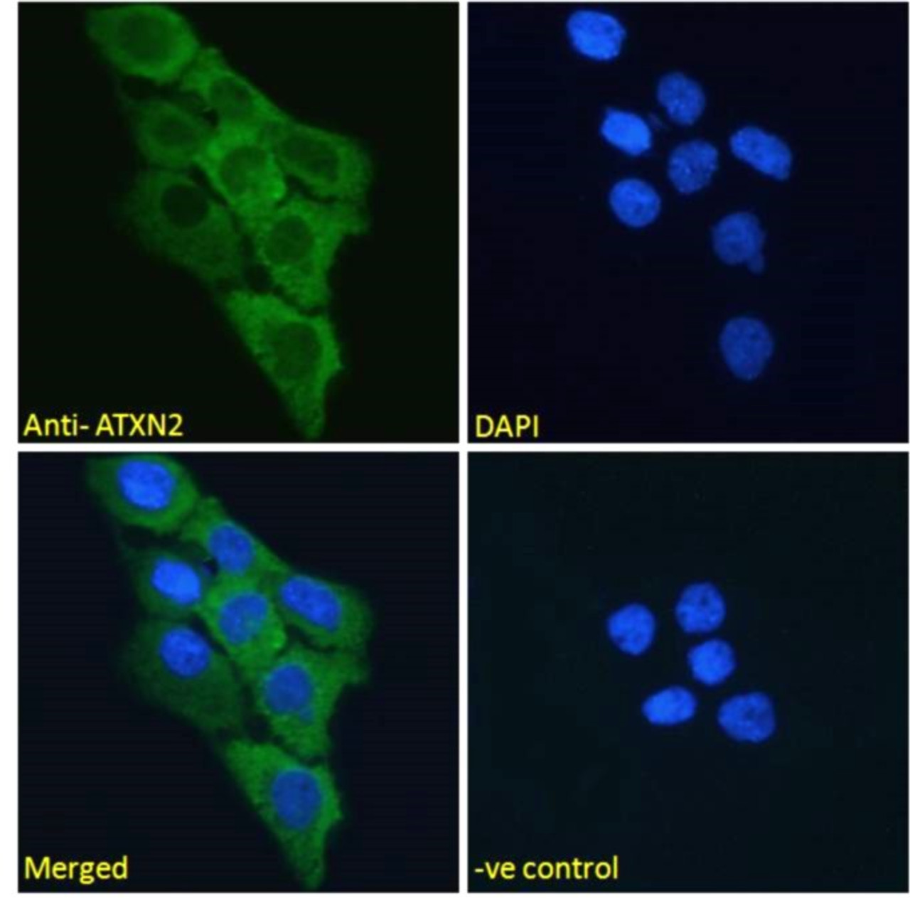 42-628 Immunofluorescence analysis of paraformaldehyde fixed NIH3T3 cells, permeabilized with 0.15% Triton. Primary incubation 1hr (10ug/ml) followed by Alexa Fluor 488 secondary antibody (2ug/ml) , showing membrane staining. The nuclear stain is DAPI (bl