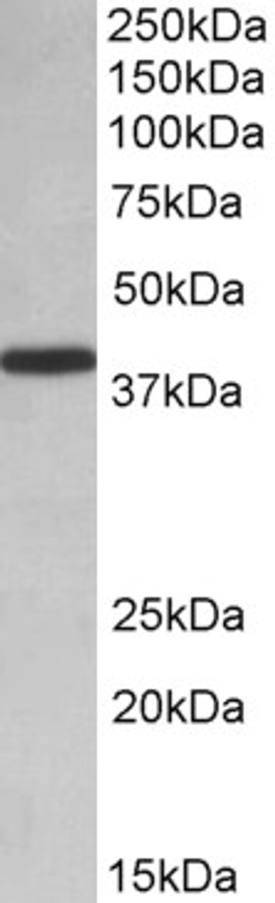 42-631 (0.2ug/ml) staining of PBMC lysate (35ug protein in RIPA buffer) . Primary incubation was 1 hour. Detected by chemiluminescence.