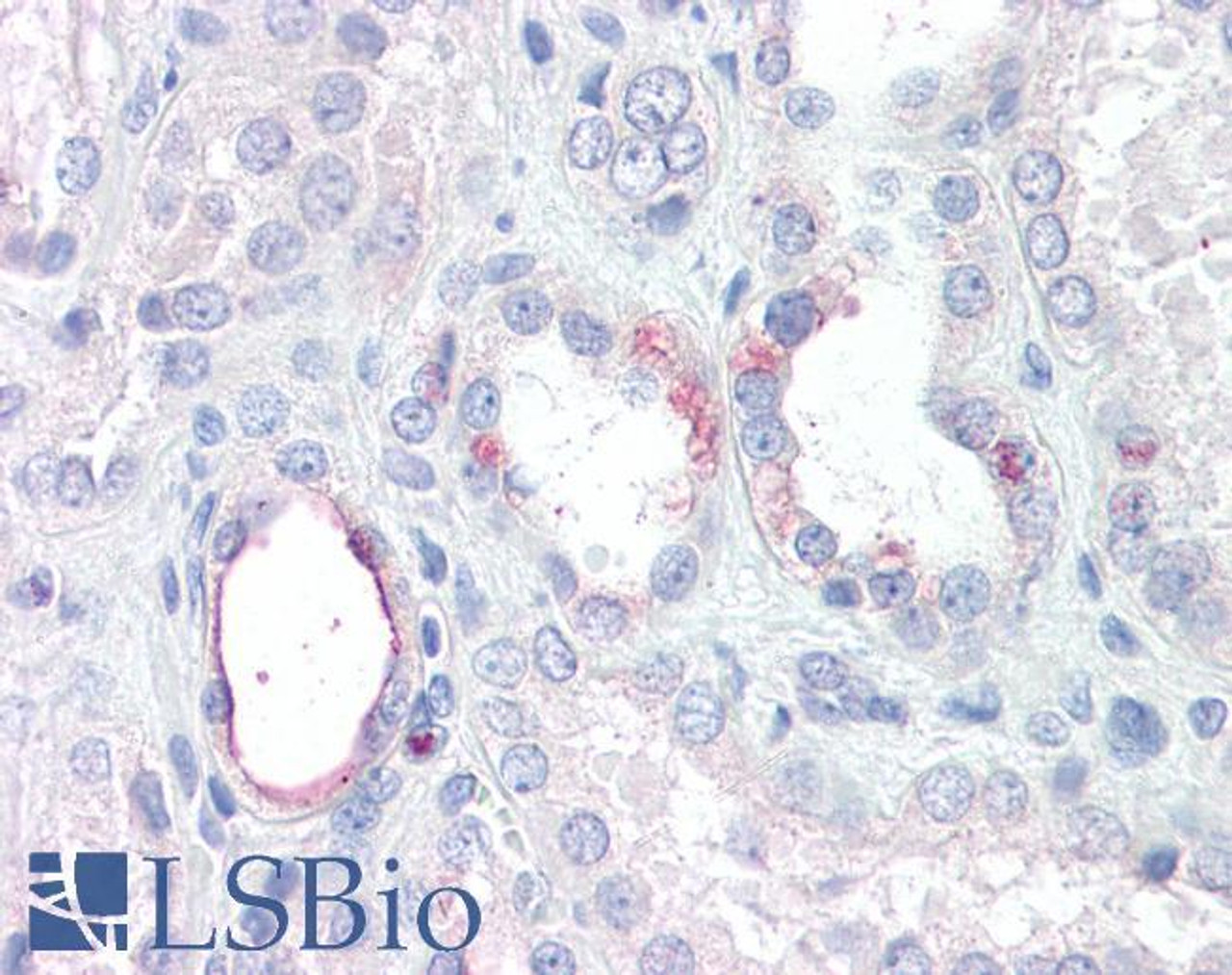 42-633 (0.01ug/ml) staining of Mouse Testis lysate (35ug protein in RIPA buffer) . Detected by chemiluminescence.