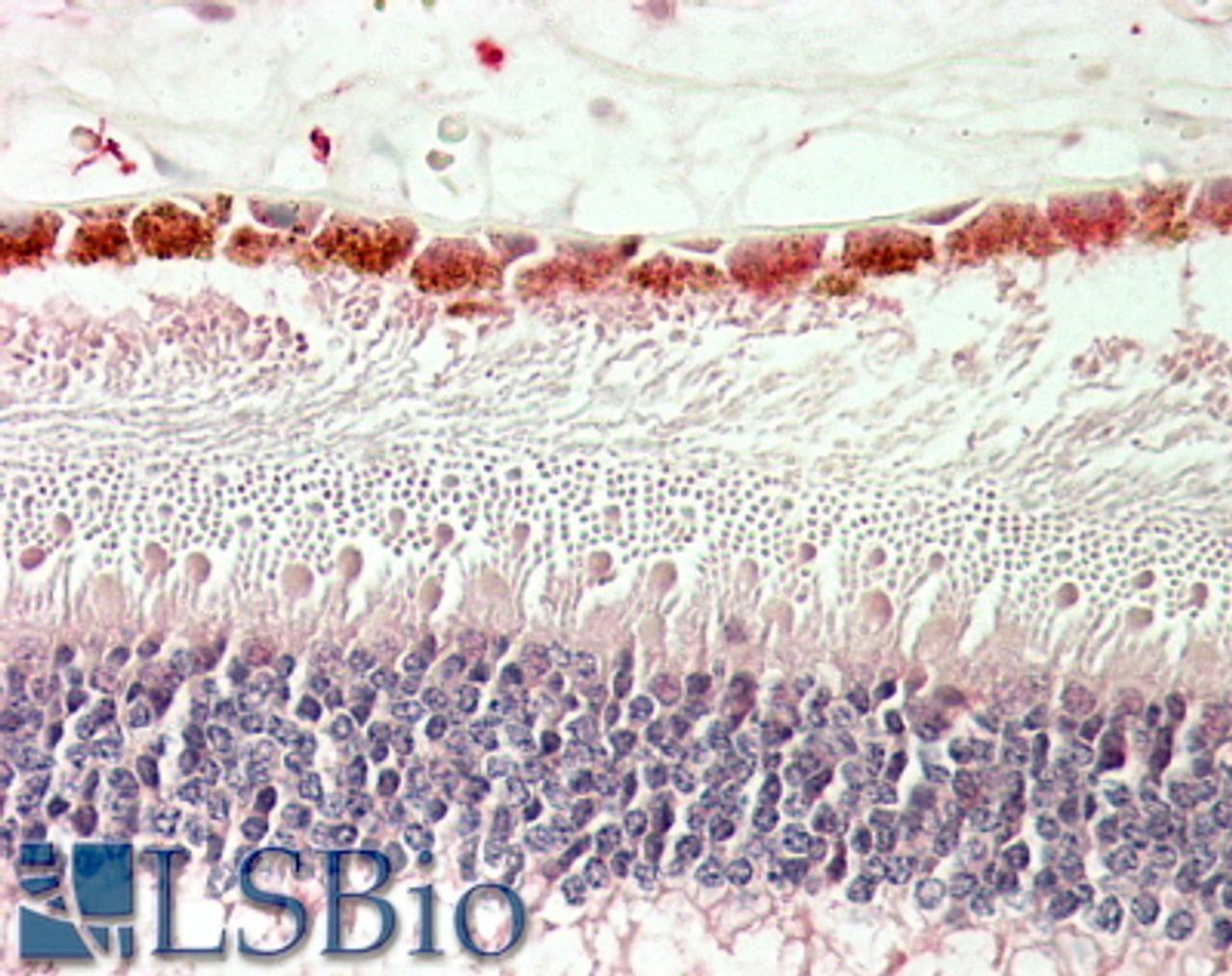 42-634 (0.3ug/ml) staining of Human Placenta lysate (35ug protein in RIPA buffer) . Detected by chemiluminescence.