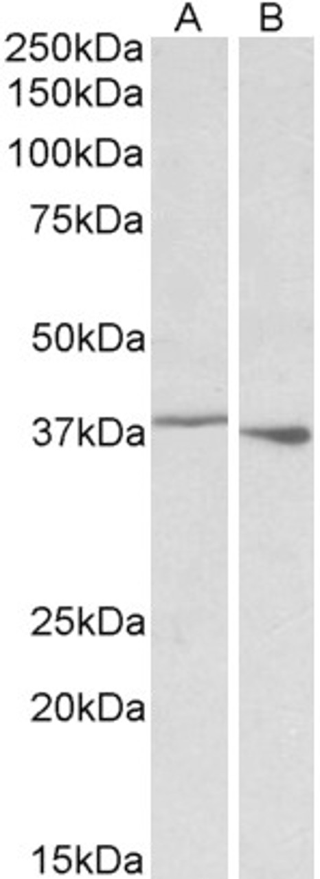 HEK293 lysate (10ug protein in RIPA buffer) overexpressing Human CSF1R with C-terminal MYC tag probed with 42-638 (1ug/ml) in Lane A and probed with anti-MYC Tag (1/1000) in lane C. Mock-transfected HEK293 probed with 42-638 (1mg/ml) in Lane B. Primary