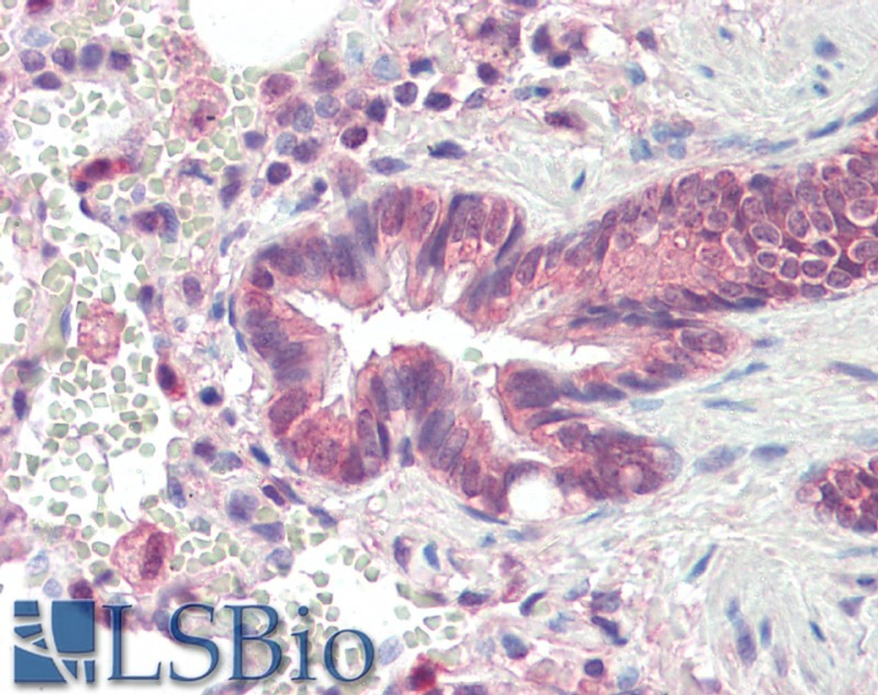 42-653 (0.1ug/ml) staining of Mouse (A) and Rat (B) Liver lysate (35ug protein in RIPA buffer) . Detected by chemiluminescence.