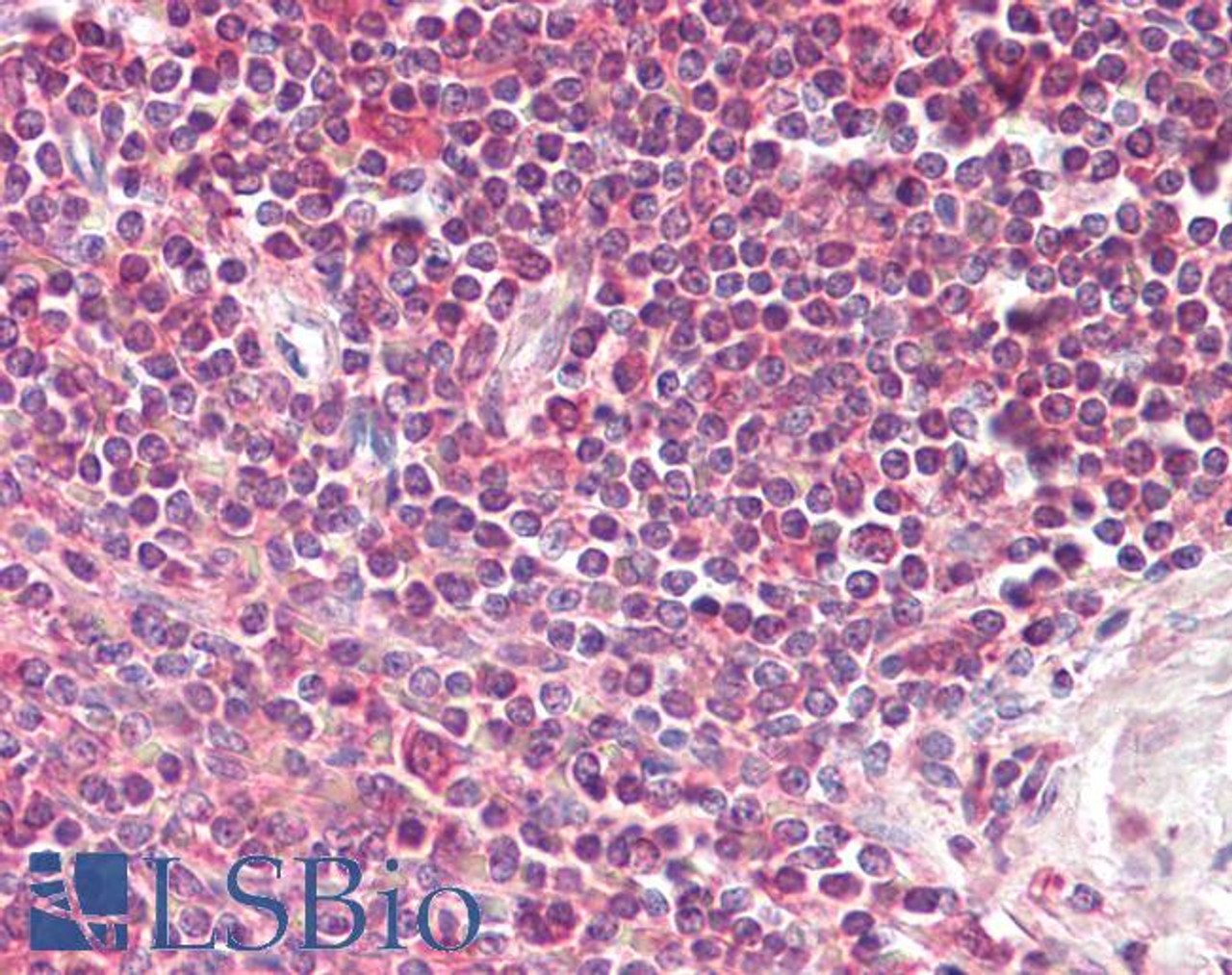 42-681 (3.8ug/ml) staining of paraffin embedded Human Skeletal Muscle. Steamed antigen retrieval with citrate buffer pH 6, AP-staining.