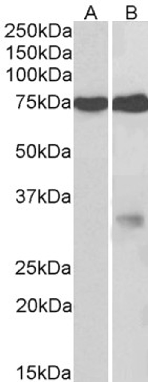 42-701 (0.1ug/ml) staining of Human Lung lysate (35ug protein in RIPA buffer) . Primary incubation was 1 hour. Detected by chemiluminescence.