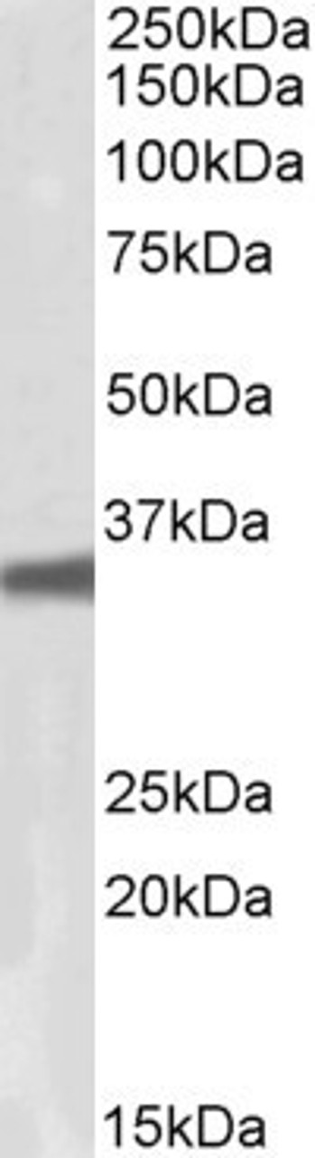 42-704 (0.1ug/ml) staining of Mouse (A) , Rat (B) and Pig (C) Heart lysates (35ug protein in RIPA buffer) . Detected by chemiluminescence.