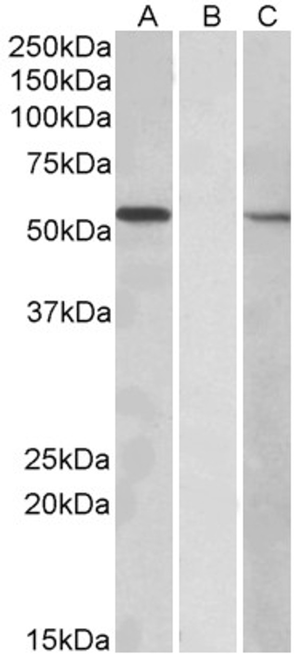 42-705 (0.3ug/ml) staining of HepG2 lysate (35ug protein in RIPA buffer) . Primary incubation was 1 hour. Detected by chemiluminescence.