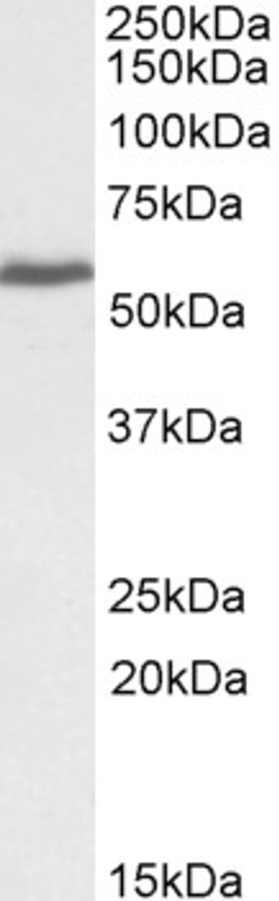 42-726 (0.3ug/ml) staining of cell line A431 lysate (35ug protein in RIPA buffer) . Primary incubation was 1 hour. Detected by chemiluminescence.