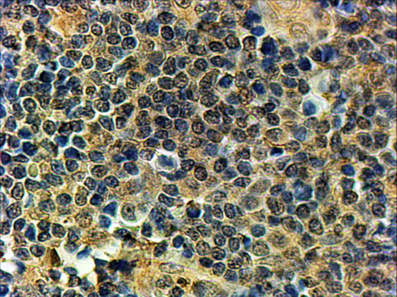 42-727 (2ug/ml) staining of paraffin embedded Human Tonsil. Steamed antigen retrieval with Tris/EDTA buffer pH 9, HRP-staining. <strong>This data is from a previous batch, not on sale.</strong>