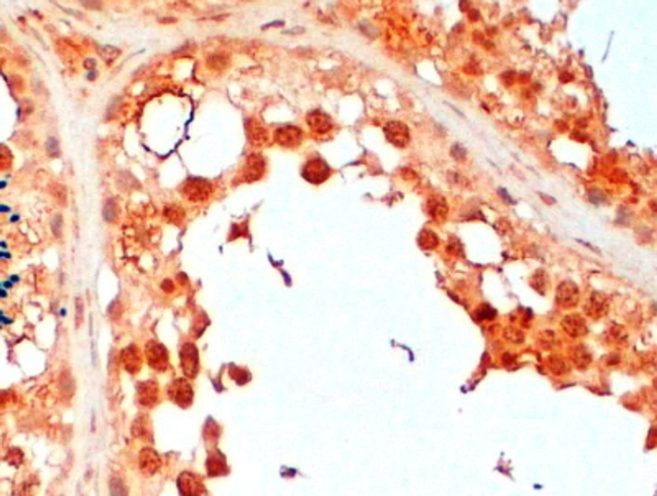 42-728 (2ug/ml) staining of paraffin embedded Human Testis. Steamed antigen retrieval with citrate buffer pH 6, HRP-staining.