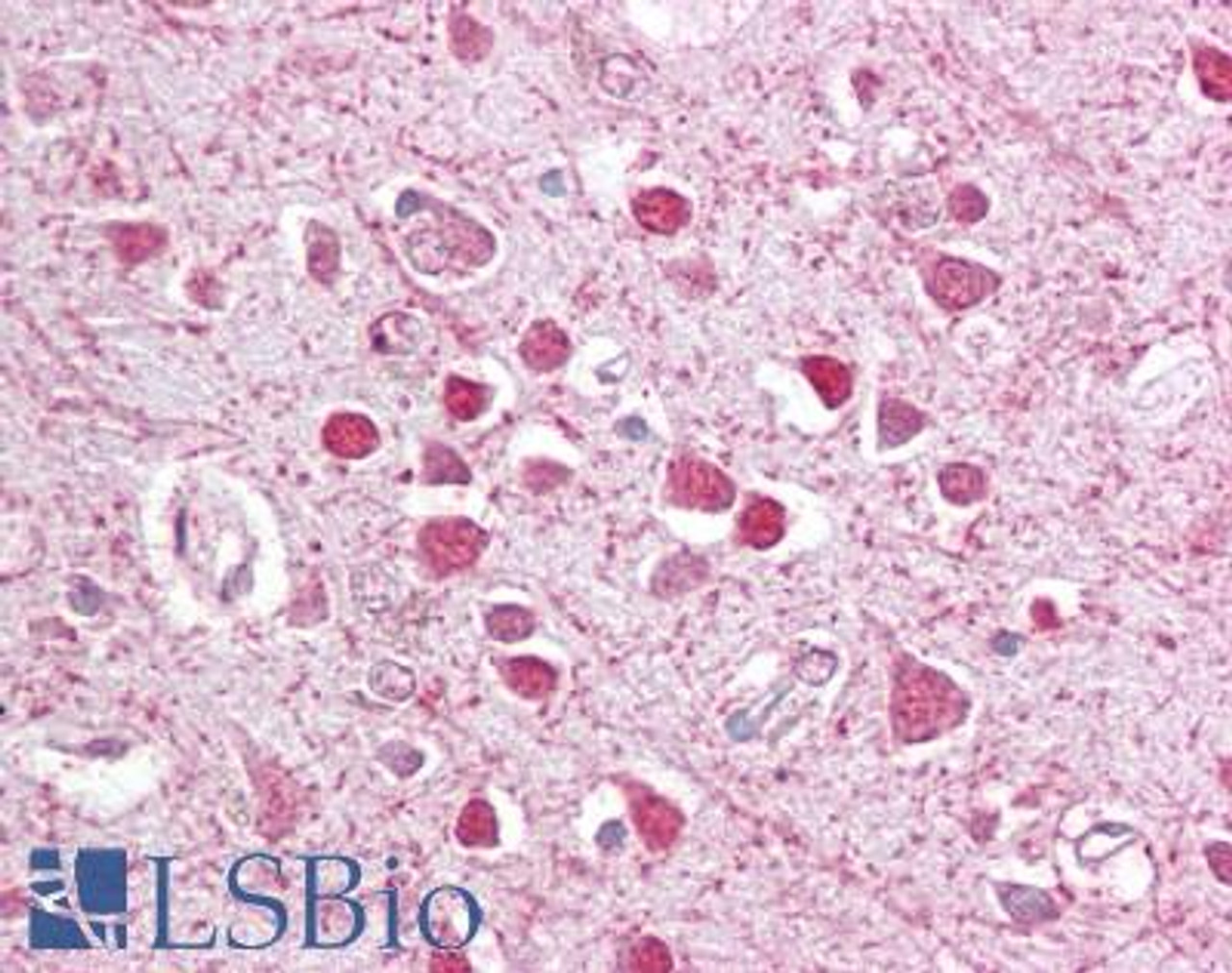 42-733 (3.75ug/ml) staining of paraffin embedded Human Intestine. Steamed antigen retrieval with citrate buffer pH 6, AP-staining. <strong>This data is from a previous batch, not on sale.</strong>