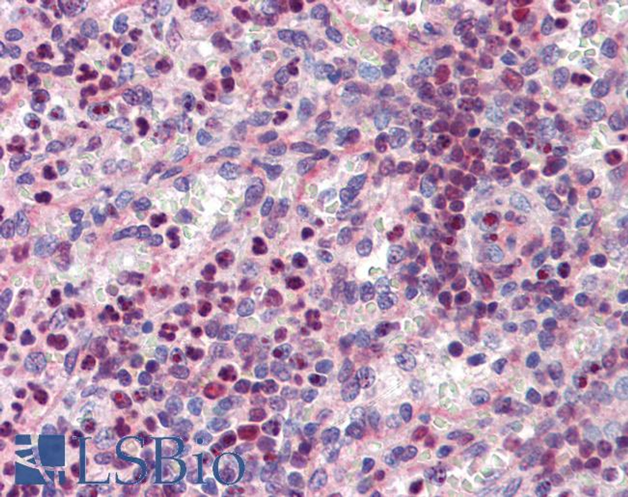 42-747 (0.1ug/ml) staining of Human Kidney lysate (35ug protein in RIPA buffer) . Primary incubation was 1 hour. Detected by chemiluminescence.