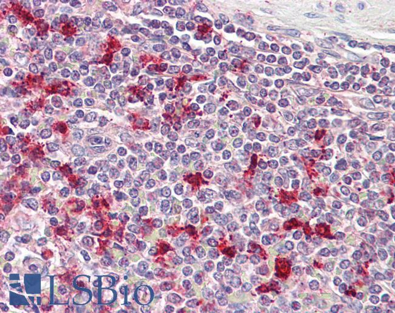 42-757 (0.5ug/ml) staining of Human Lung lysate (35ug protein in RIPA buffer) . Primary incubation was 1 hour. Detected by chemiluminescence.