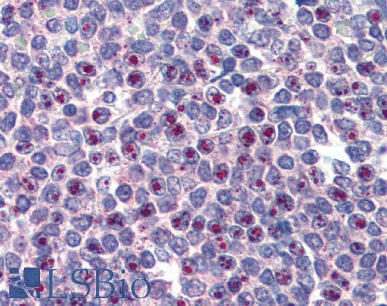 45-603 (3.75ug/ml) staining of paraffin embedded Human Spleen. Steamed antigen retrieval with citrate buffer pH 6, AP-staining. <strong>This data is from a previous batch, not on sale.</strong>