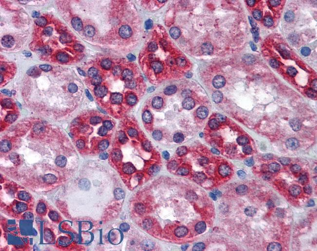 42-765 (1ug/ml) staining of Human Cerebellum lysate (35ug protein in RIPA buffer) . Primary incubation was 1 hour. Detected by chemiluminescence.