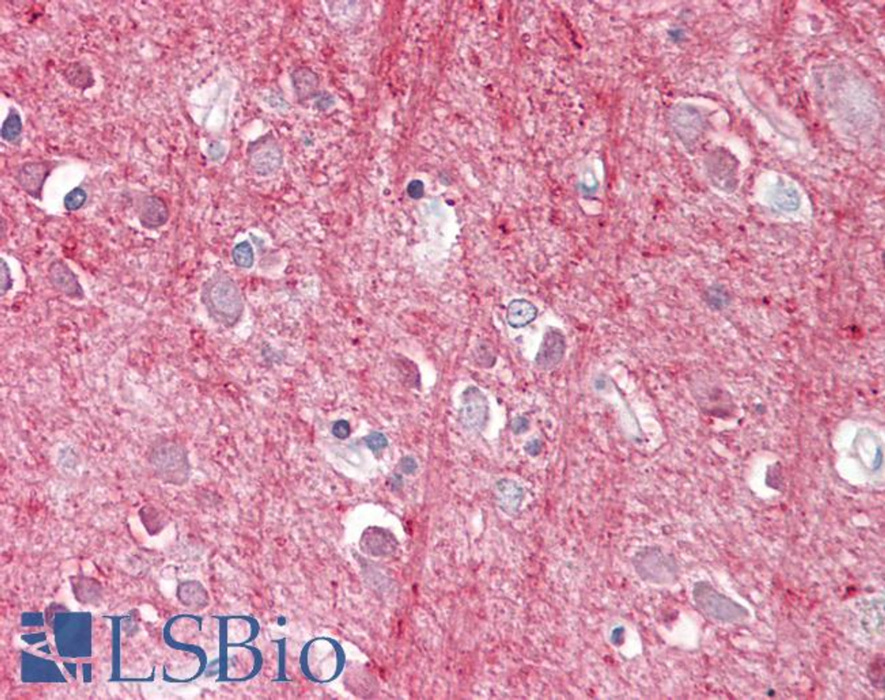 42-775 (5ug/ml) staining of paraffin embedded Human Lung. Steamed antigen retrieval with citrate buffer pH 6, AP-staining.