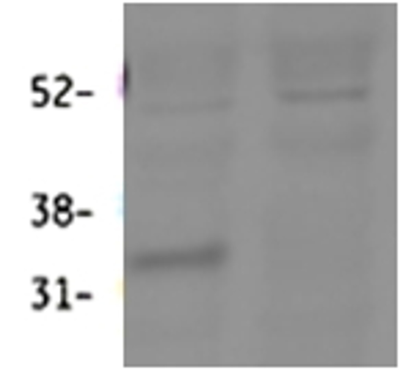 HEK293 lysate (10ug protein in RIPA buffer) over expressing Human DAP with DYKDDDDK tag probed with 42-779 (0.1ug/ml) in Lane A and probed with anti- DYKDDDDK Tag (1/3000) in lane C. Mock-transfected HEK293 probed with 42-779 (1mg/ml) in Lane B. Prima