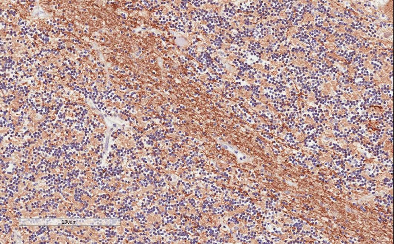 42-788 (3.8ug/ml) staining of paraffin embedded Human Skin. Steamed antigen retrieval with citrate buffer pH 6, AP-staining.