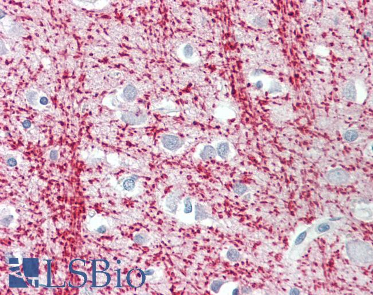 42-789 (0.001ug/ml) staining of Human Cerebellum lysate (35ug protein in RIPA buffer) . Detected by chemiluminescence.