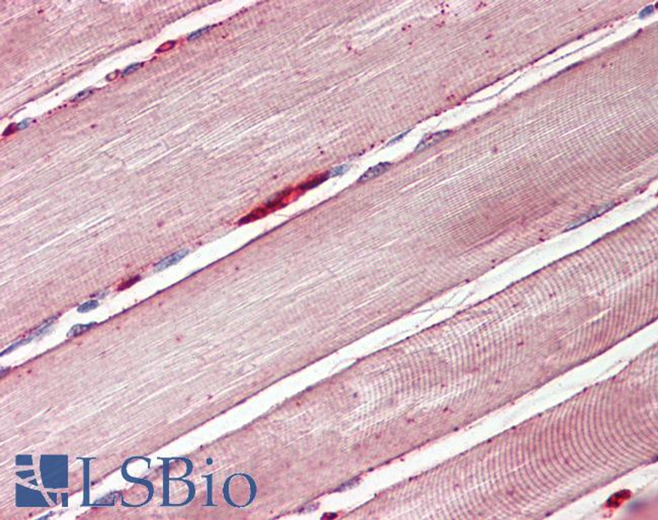 HEK293 lysate (10ug protein in RIPA buffer) overexpressing Human CST8 (RC210130) with C-terminal MYC tag probed with 42-790 (1ug/ml) in Lane A and probed with anti-MYC Tag (1/1000) in lane C. Mock-transfected HEK293 probed with 42-790 (1mg/ml) in Lane B