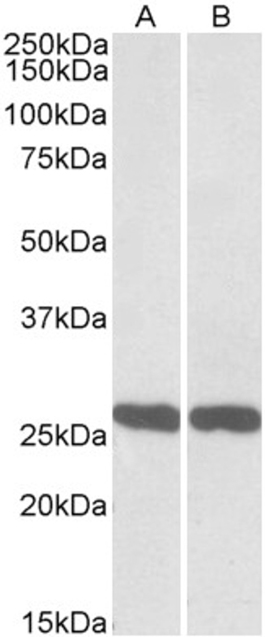 42-794 (2ug/ml) staining of Human Breast cancer lysate (35ug protein in RIPA buffer) . Primary incubation was 1 hour. Detected by chemiluminescence.