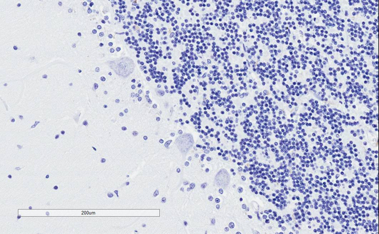 42-798 (1ug/ml) staining of Human Bone Marrow lysate (35ug protein in RIPA buffer) . Primary incubation was 1 hour. Detected by chemiluminescence.