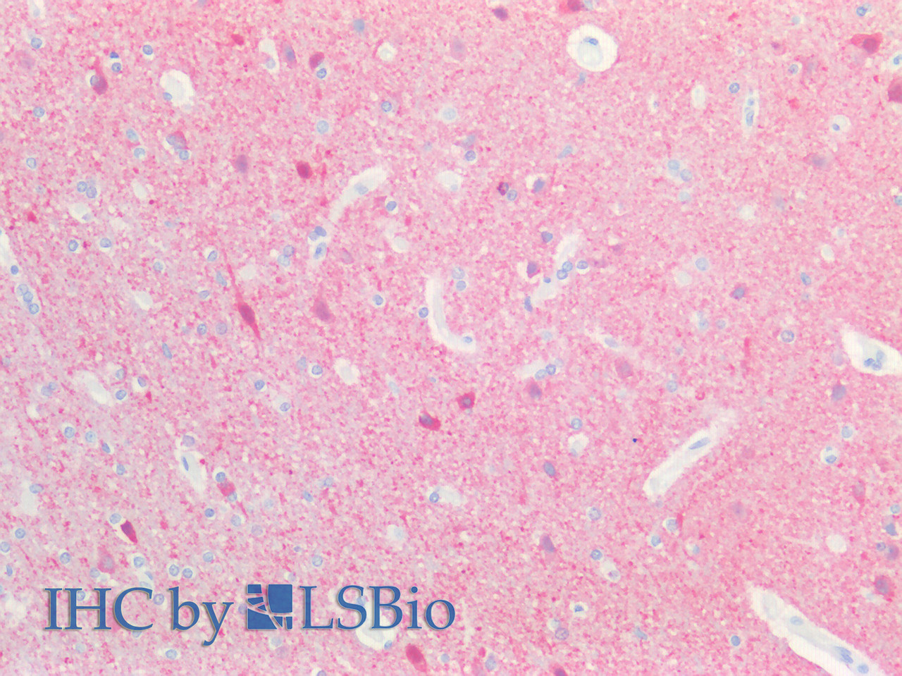 42-805 (2ug/ml) staining of nuclear lysate of NIH3T3 (35ug protein in RIPA buffer) . Primary incubation was 1 hour. Detected by chemiluminescence.