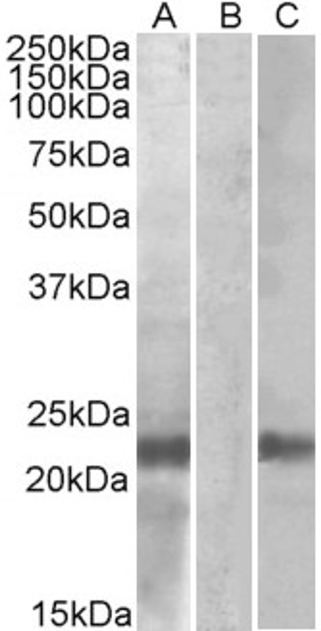 42-809 (0.1ug/ml) staining of Human Heart lysate (35ug protein in RIPA buffer) . Primary incubation was 1 hour. Detected by chemiluminescence.