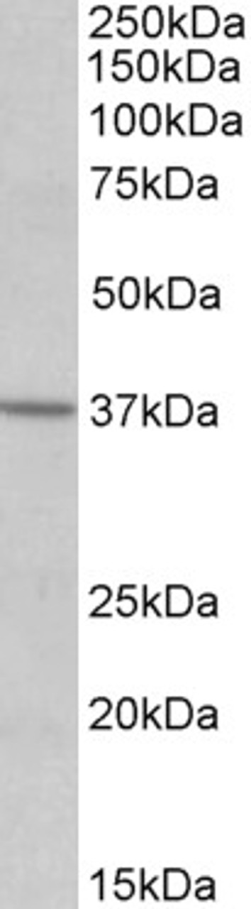 42-814 (0.3ug/ml) staining of K562 lysate (35ug protein in RIPA buffer) . Primary incubation was 1 hour. Detected by chemiluminescence.